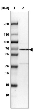 Anti-NR1D2 Antibody