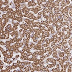 Anti-TTC39B Antibody