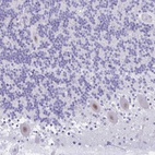 Anti-GLB1L2 Antibody