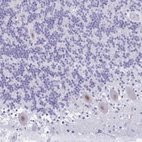 Anti-GLB1L2 Antibody