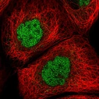 Immunofluorescent staining of human cell line A-431 shows localization to nucleoplasm.