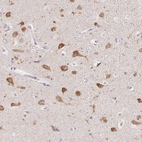 Immunohistochemical staining of human cerebral cortex shows high expression.