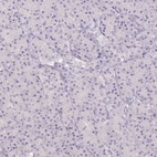 Anti-PNMAL2 Antibody