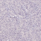 Immunohistochemical staining of human pancreas shows low expression as expected.
