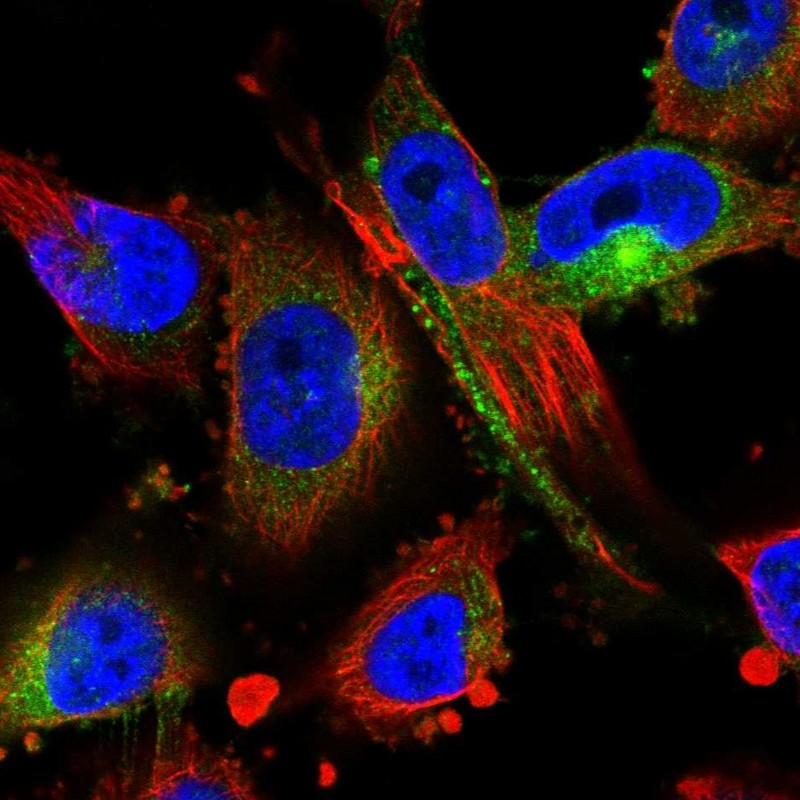 Anti-MARCKS Antibody