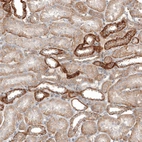 Immunohistochemical staining of human kidney shows moderate membraneous positivity in cells in tubules.