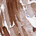 Immunohistochemical staining of human skeletal muscle shows high expression.