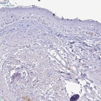 Immunohistochemical staining of human skin shows low expression as expected.