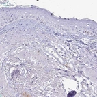 Immunohistochemical staining of human skin shows low expression as expected.