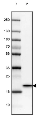 Lane 1: Marker [kDa] 250, 130, 100, 70, 55, 35, 25, 15, 10_br/_Lane 2: Human Skeletal muscle tissue