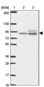 Lane 1: Marker [kDa] 250, 130, 95, 72, 55, 36, 28, 17, 10_br/_Lane 2: Human cell line RT-4_br/_Lane 3: Human cell line U-251MG sp