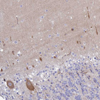 Anti-CA10 Antibody