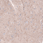 Anti-PTPRK Antibody