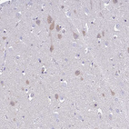 Immunohistochemical staining of human cerebral cortex shows weak cytoplasmic positivity in neurons.