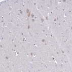 Immunohistochemical staining of human cerebral cortex shows weak cytoplasmic positivity in neurons.
