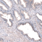 Immunohistochemical staining of human prostate shows moderate positivity in apical membranes in glandular cells.