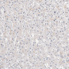 Immunohistochemical staining of human liver shows no positivity in hepatocytes as expected.