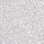 Anti-GPC3 Antibody