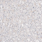 Immunohistochemical staining of human liver shows no positivity in hepatocytes as expected.