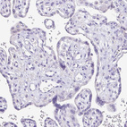 Immunohistochemical staining of human placenta shows no positivity in trophoblastic cells as expected.