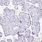 Immunohistochemical staining of human placenta shows no positivity in trophoblastic cells as expected.