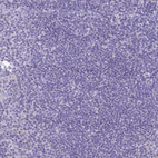 Immunohistochemical staining of human tonsil shows no positivity in non-germinal center cells as expected.