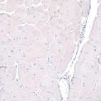 Immunohistochemical staining of human skeletal muscle shows no positivity in striated muscle fibers as expected.