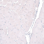 Anti-PTPRK Antibody