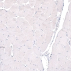 Immunohistochemical staining of human skeletal muscle shows no positivity in striated muscle fibers as expected.