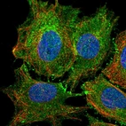 Immunofluorescent staining of human cell line SiHa shows localization to plasma membrane & cell junctions.