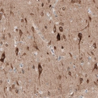 Anti-PTPRD Antibody