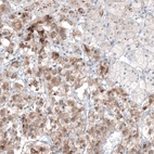 Immunohistochemical staining of human adrenal gland shows moderate cytoplasmic positivity in glandular cells in medulla.