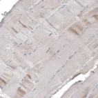 Immunohistochemical staining of human skeletal muscle shows no positivity in myocytes as expected.