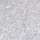 Immunohistochemical staining of human liver shows no positivity in hepatocytes as expected.