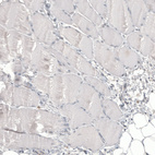 Immunohistochemical staining of human skeletal muscle shows no positivity in myocytes as expected.