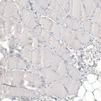 Anti-GPC3 Antibody