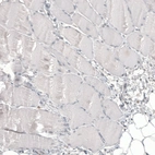 Immunohistochemical staining of human skeletal muscle shows no positivity in myocytes as expected.