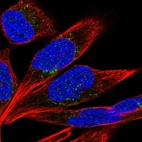 Immunofluorescent staining of human cell line RH-30 shows localization to vesicles.