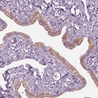 Immunohistochemical staining of human fallopian tube shows high expression.