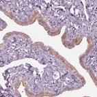 Immunohistochemical staining of human fallopian tube shows high expression.