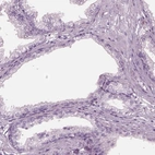 Immunohistochemical staining of human prostate shows low expression as expected.