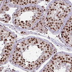 Anti-TTF1 Antibody