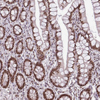 Immunohistochemical staining of human small intestine shows strong nuclear positivity in glandular cells.