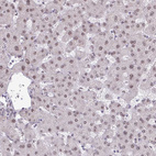Immunohistochemical staining of human liver shows weak nuclear positivity in hepatocytes.