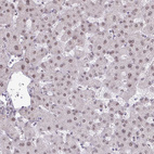 Anti-TTF1 Antibody