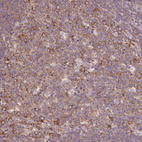 Anti-RPS23 Antibody
