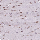 Immunohistochemical staining of human cerebral cortex shows moderate cytoplasmic positivity in neurons.