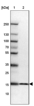 Anti-RPS23 Antibody