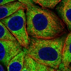 Immunofluorescent staining of human cell line MCF7 shows localization to cytosol & endoplasmic reticulum.