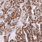 Anti-NCAM1 Antibody